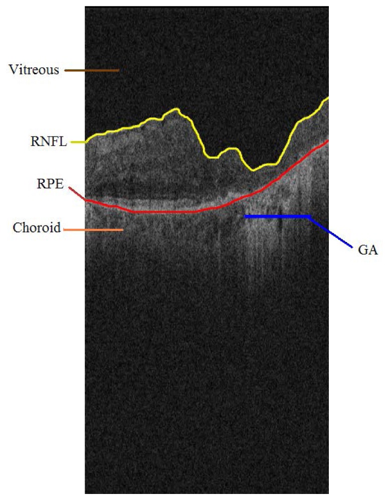 Fig. 2