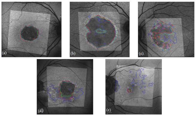 Fig. 11