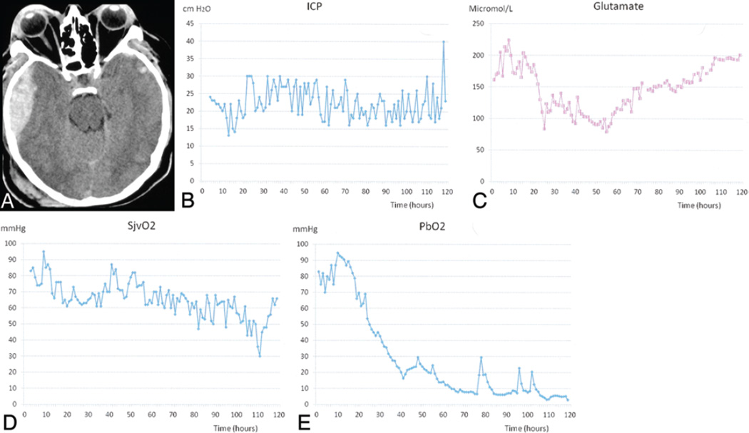 Fig. 3