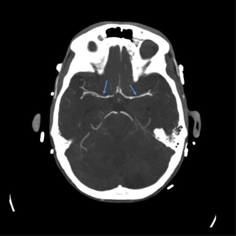 Fig. 2