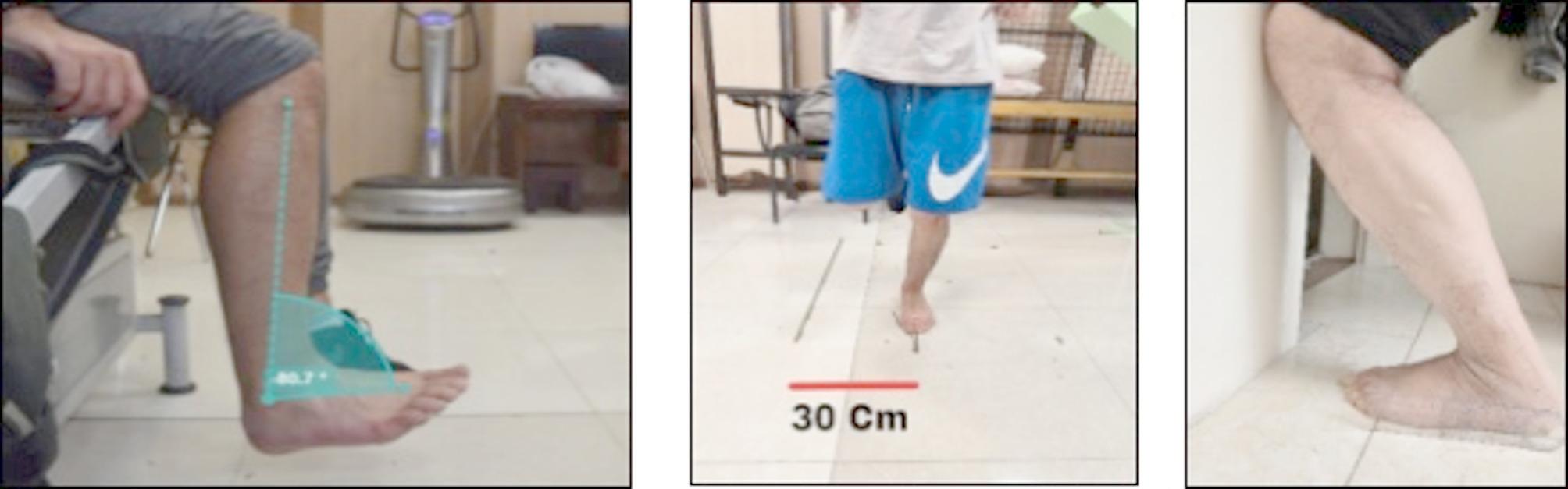 Fig. 4