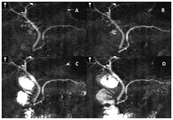 Figure 18