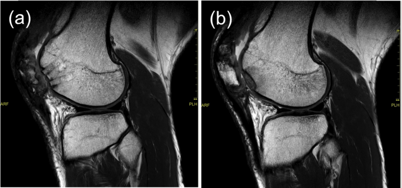 Fig. 5