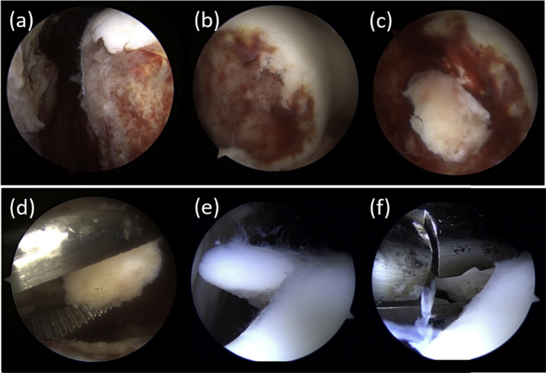 Fig. 3