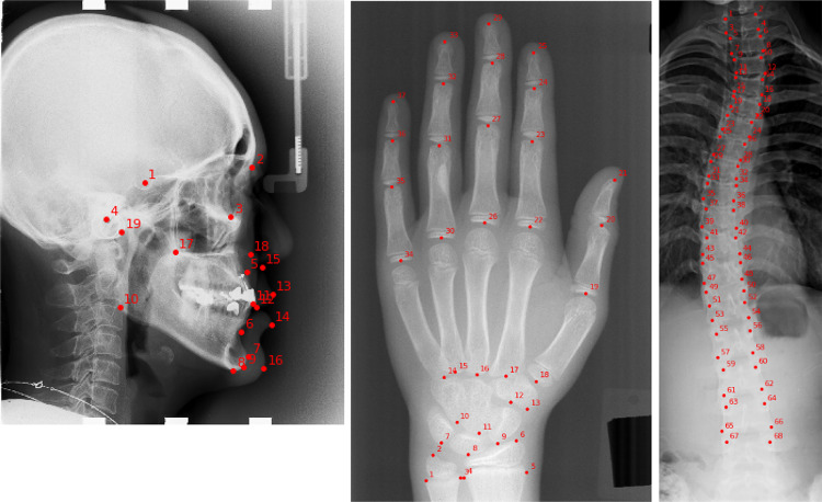 Fig. 1