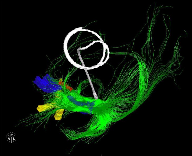 FIGURE 3