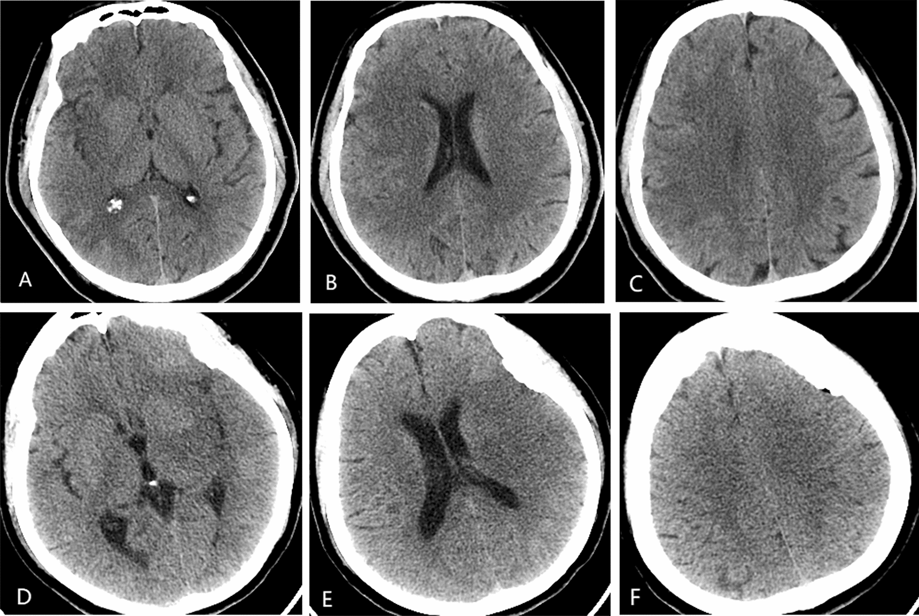 Fig. 2