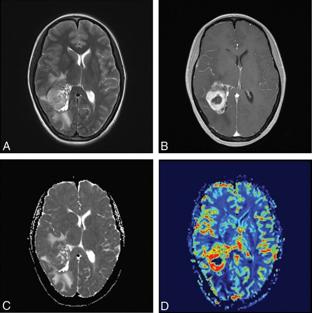 Fig 2.