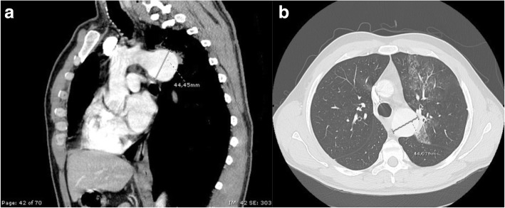 Fig. 2