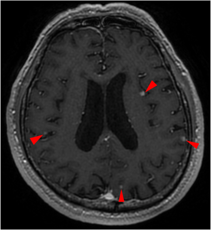 Fig. 2