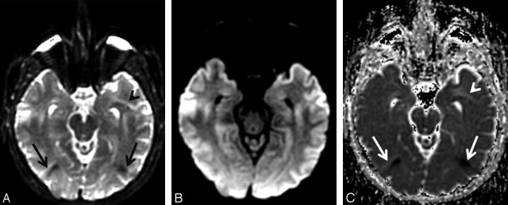 Fig 6.