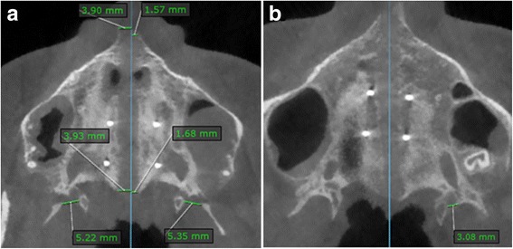 Fig. 7