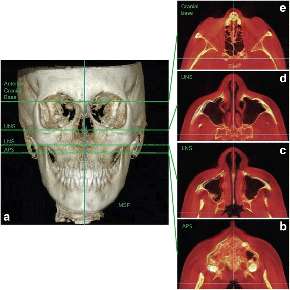 Fig. 5