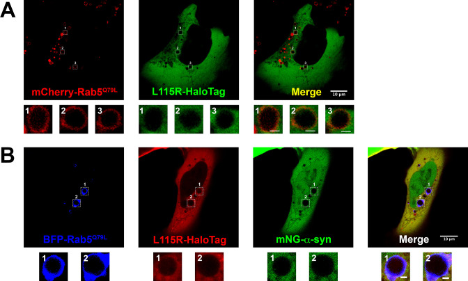 Figure 4—figure supplement 2.