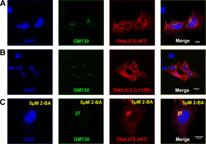 Figure 3—figure supplement 3.