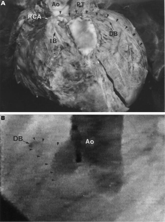 Figure 4  