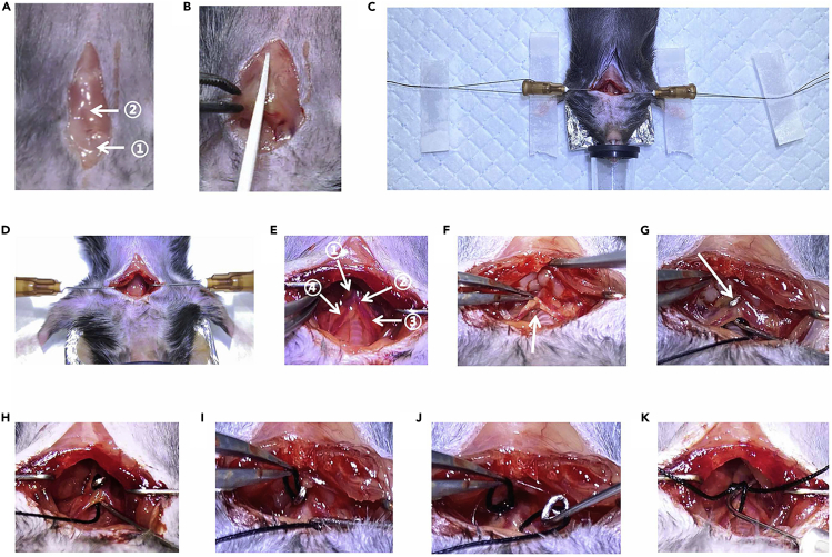 Figure 2