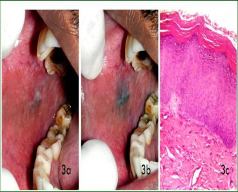 graphic file with name EJHS2603-0201Fig3.jpg