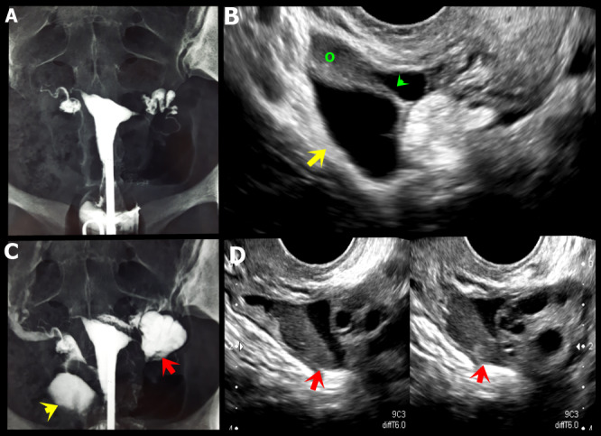 Figure 14