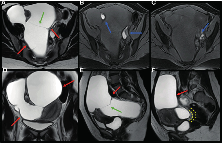 Figure 13