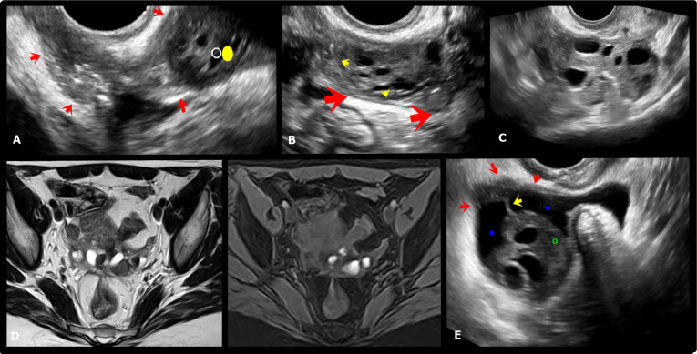 Figure 11