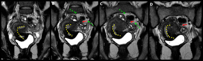 Figure 12