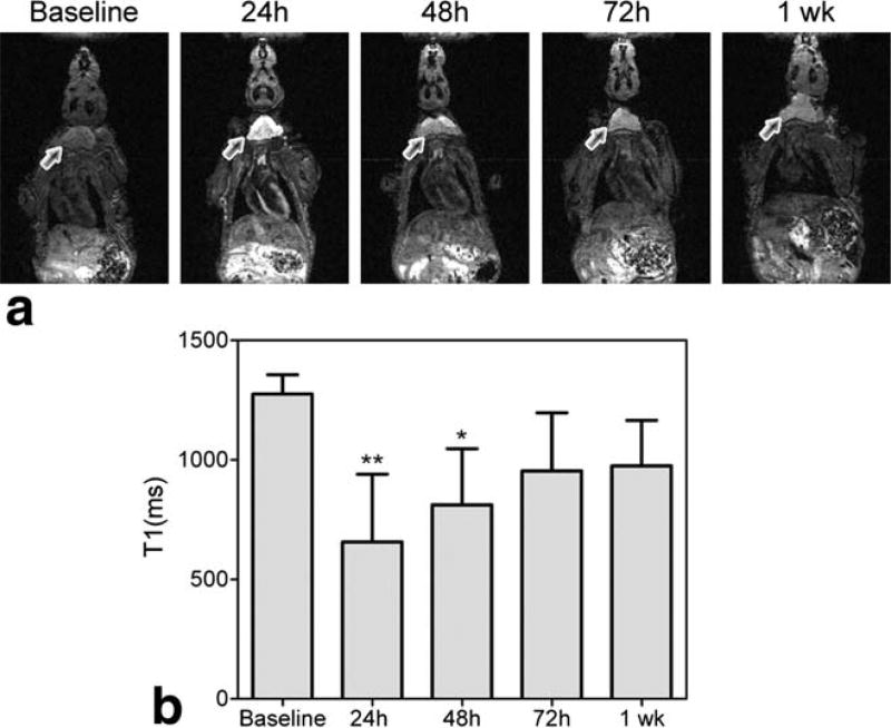 FIG. 1