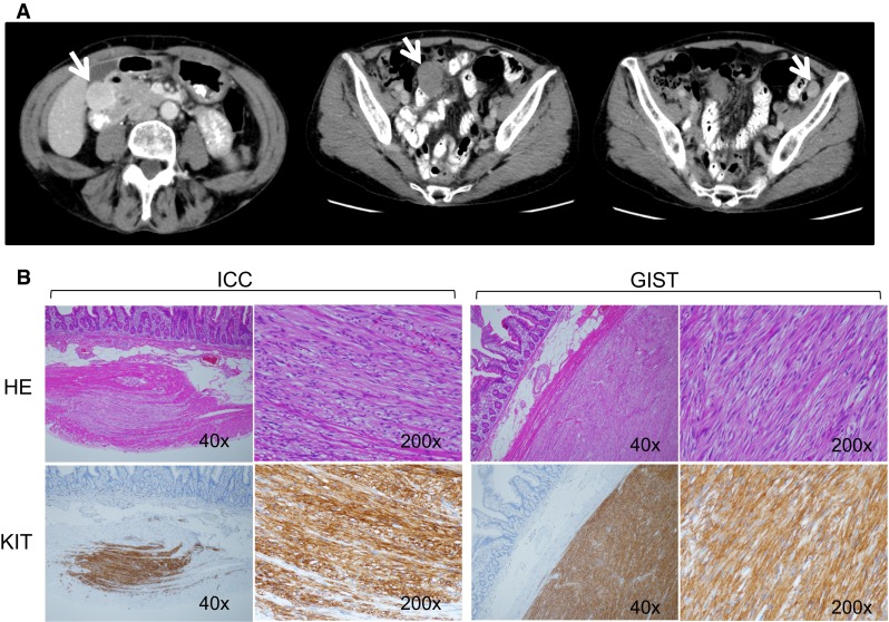 Fig. 1