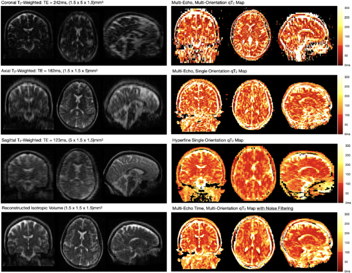 MRM-29273-FIG-0002-c