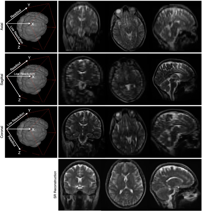 MRM-29273-FIG-0001-c