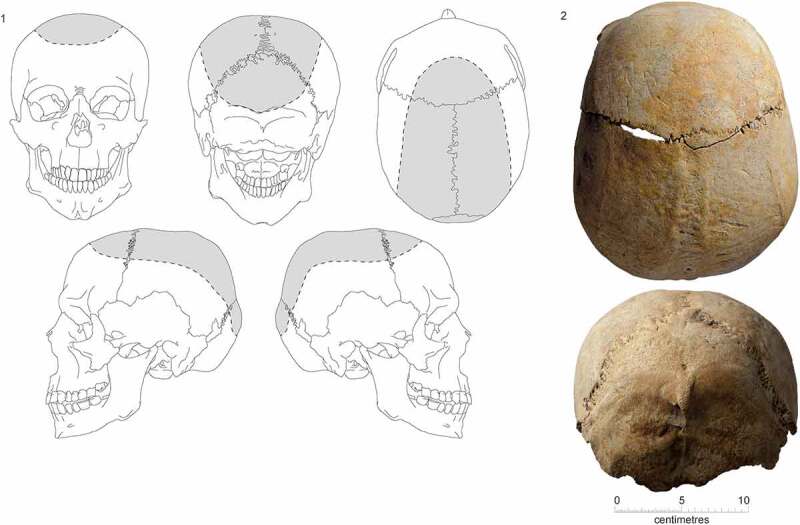 Figure 14.