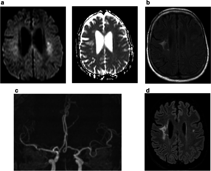 Fig. 4