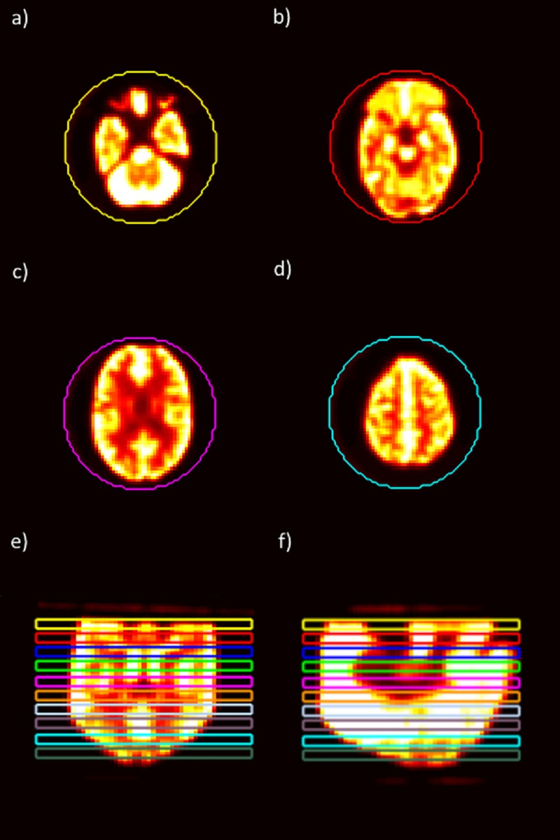 Fig 1