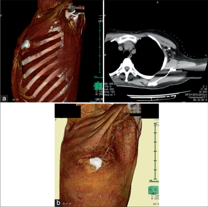 Figure 4: