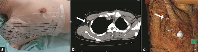 Figure 1: