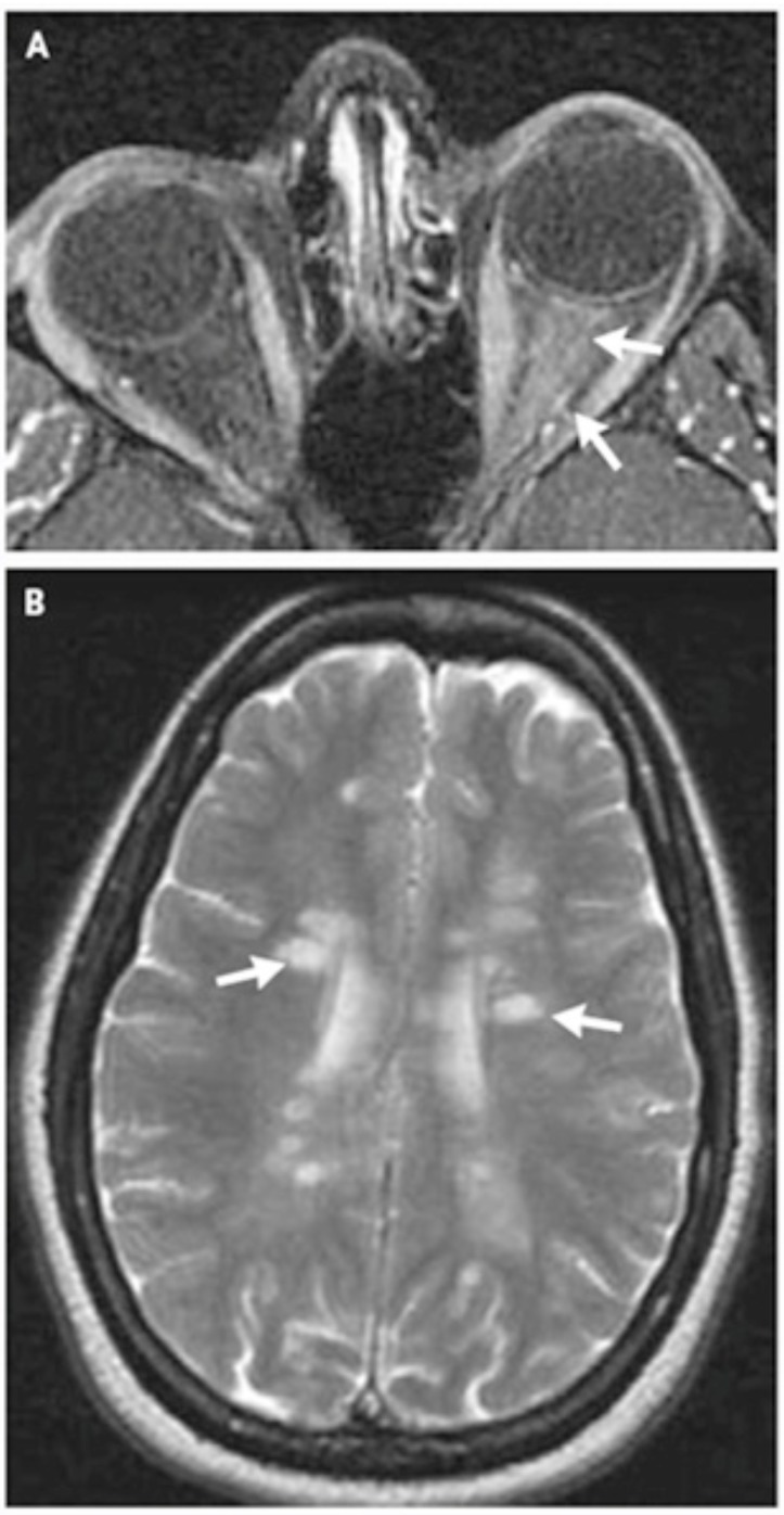 Fig. (1)