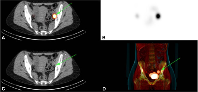 Fig. 3