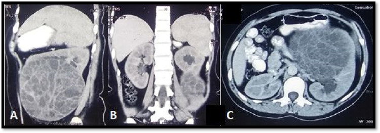 Fig. 1