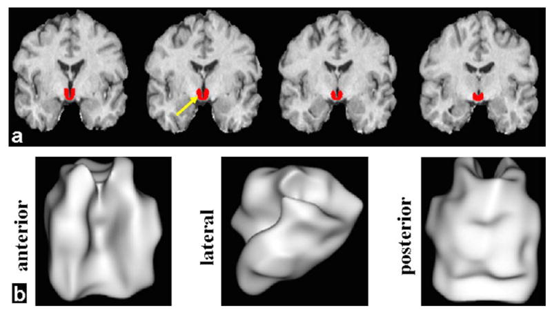 FIGURE 1