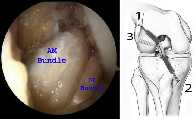 Fig 16