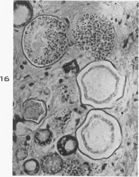 Fig. 16