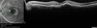 Figure 6