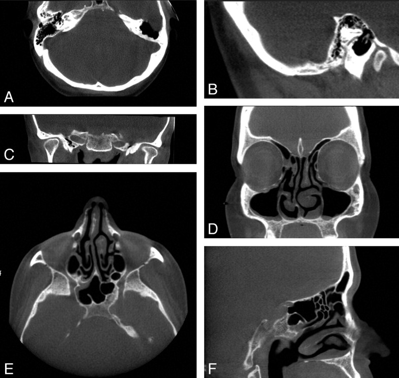 Fig 3.