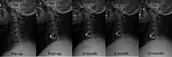 Fig. 8