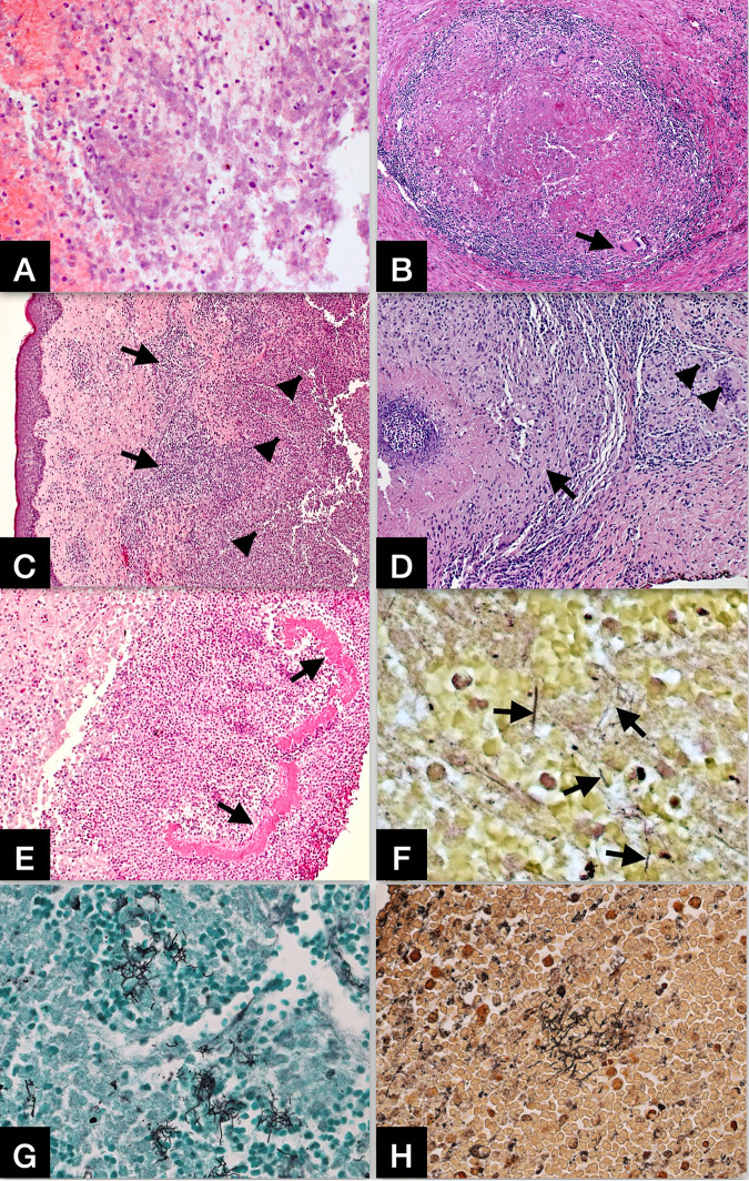 FIG 1