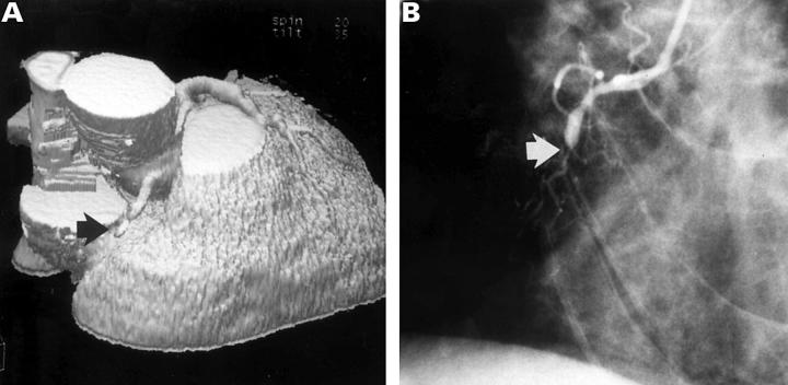 Figure 3  