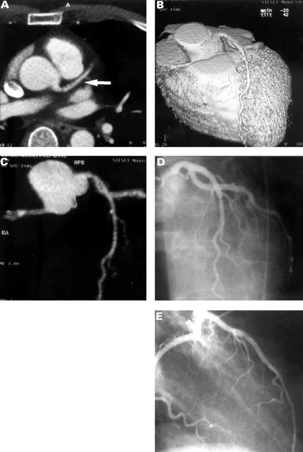 Figure 1  