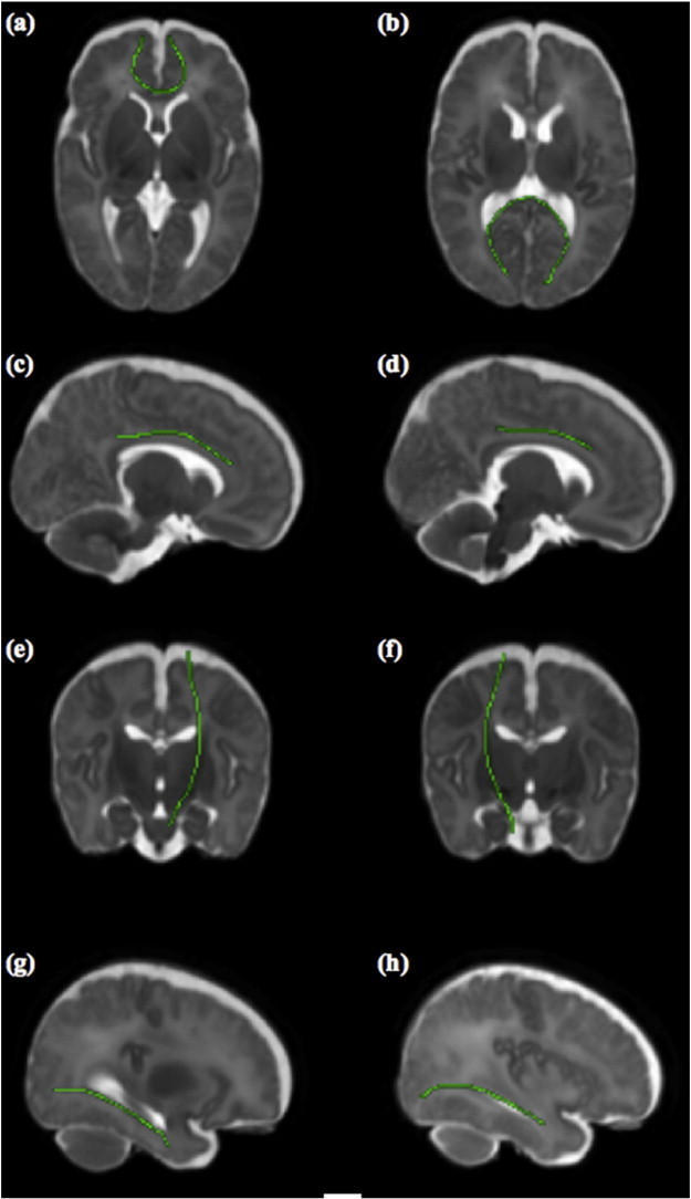 Fig. 1