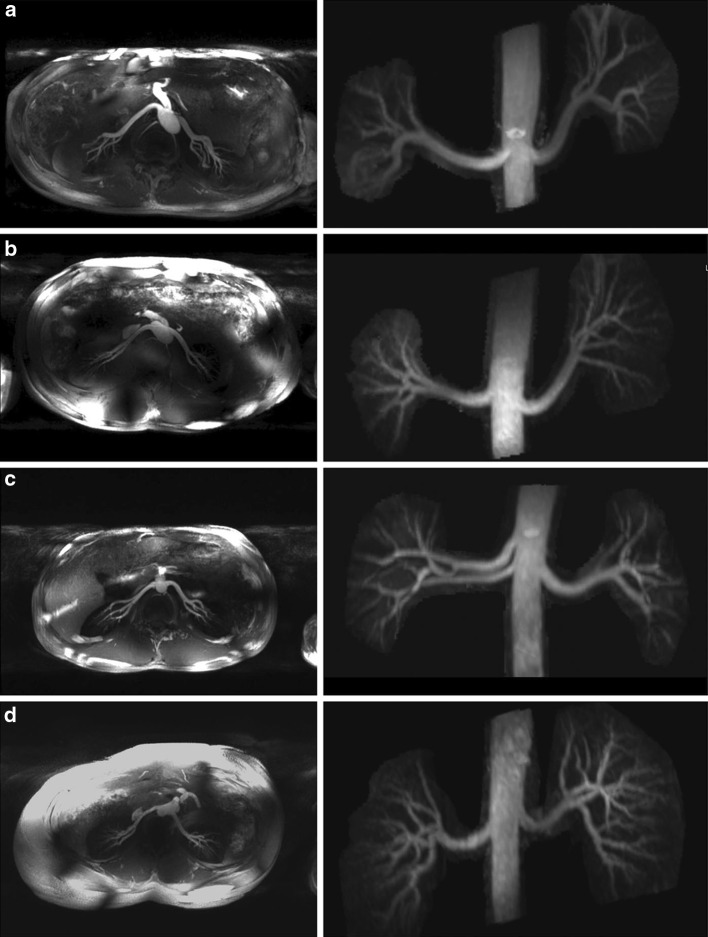 Fig. 10