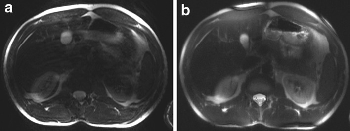 Fig. 5